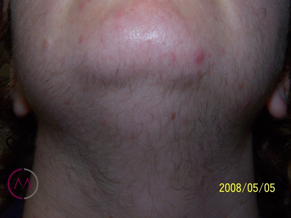 Before image