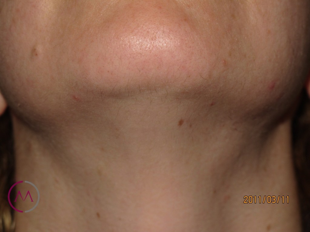 After image