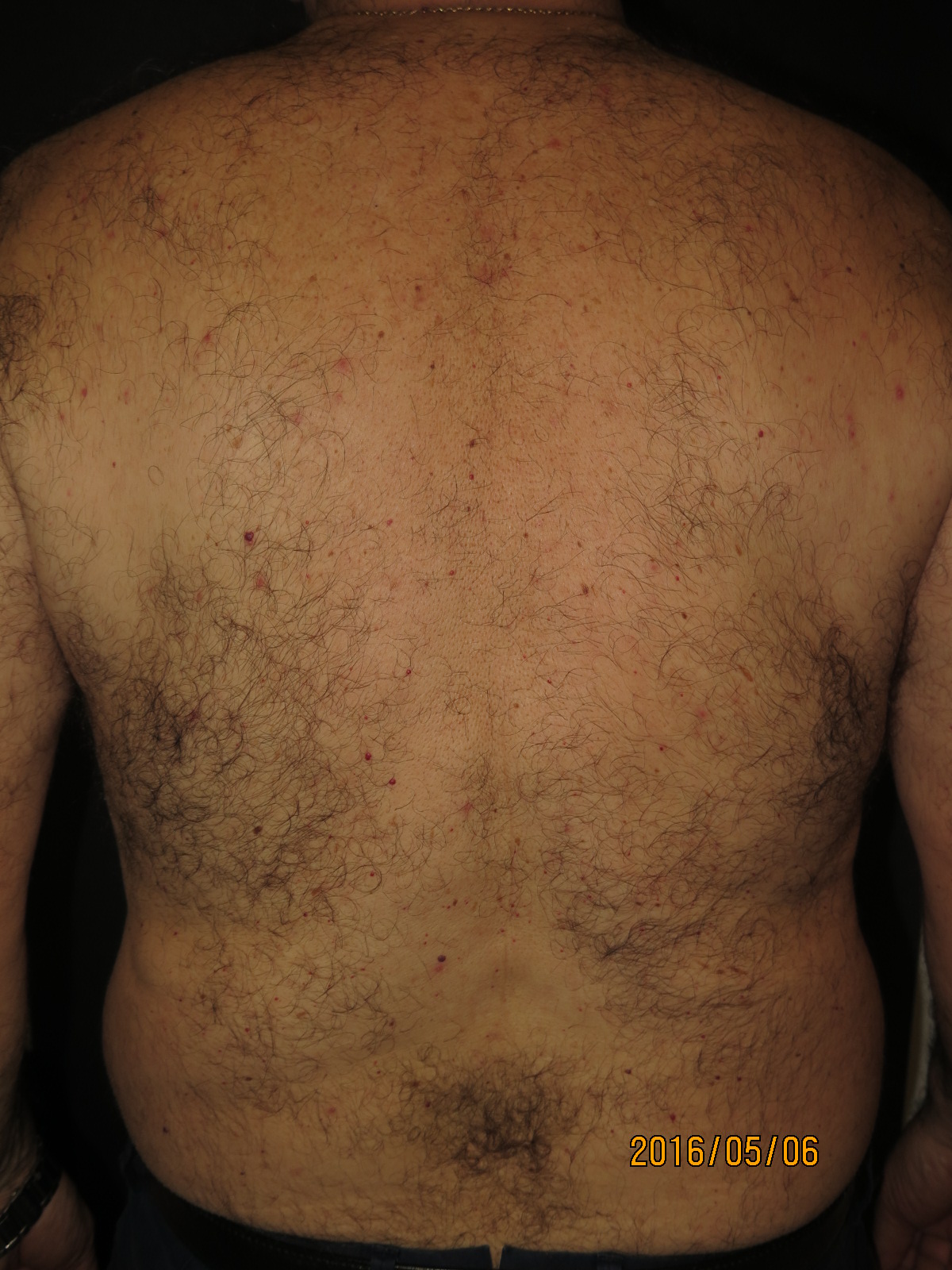 Before image