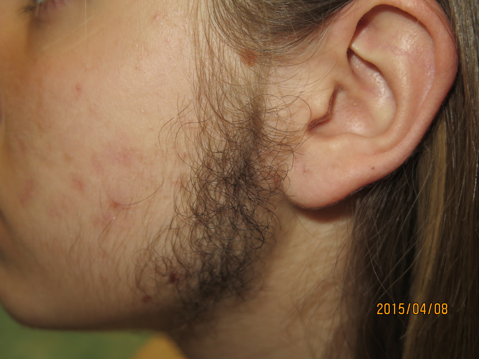 Before image