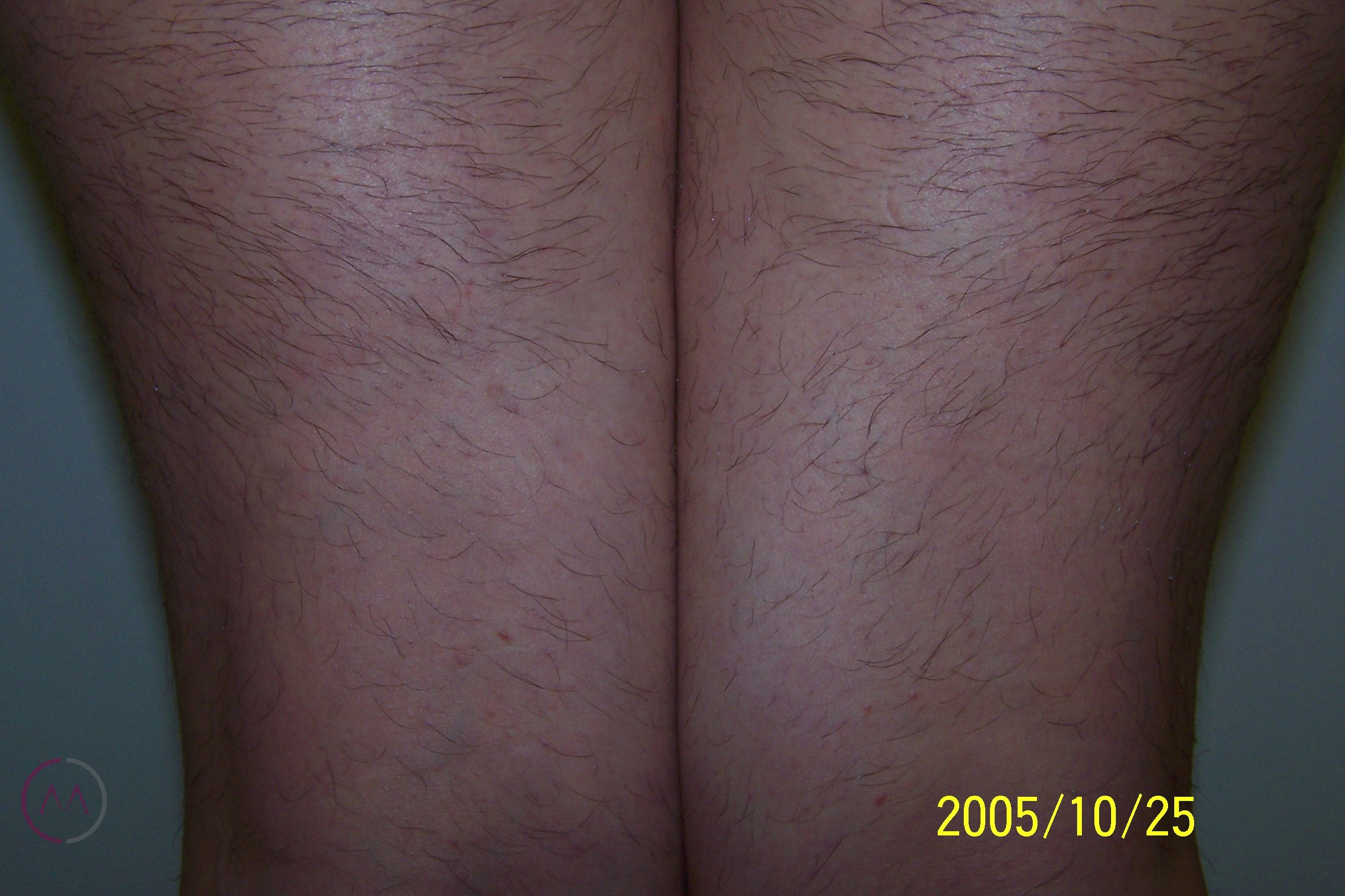 Before image