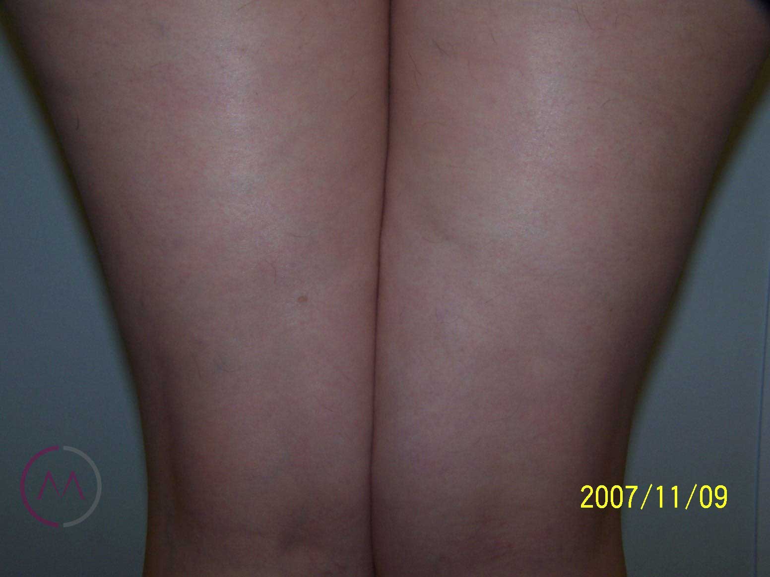 After image